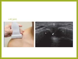 Radiological Examination of Shoulder and Elbow | PDF