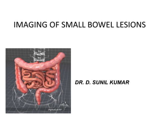 IMAGING OF SMALL BOWEL LESIONS
DR. D. SUNIL KUMAR
 