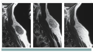 Imaging and Diagnosis of Soft Tissue Tumors | PPTX