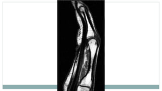 Imaging and Diagnosis of Soft Tissue Tumors | PPTX