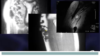 Imaging and Diagnosis of Soft Tissue Tumors | PPTX