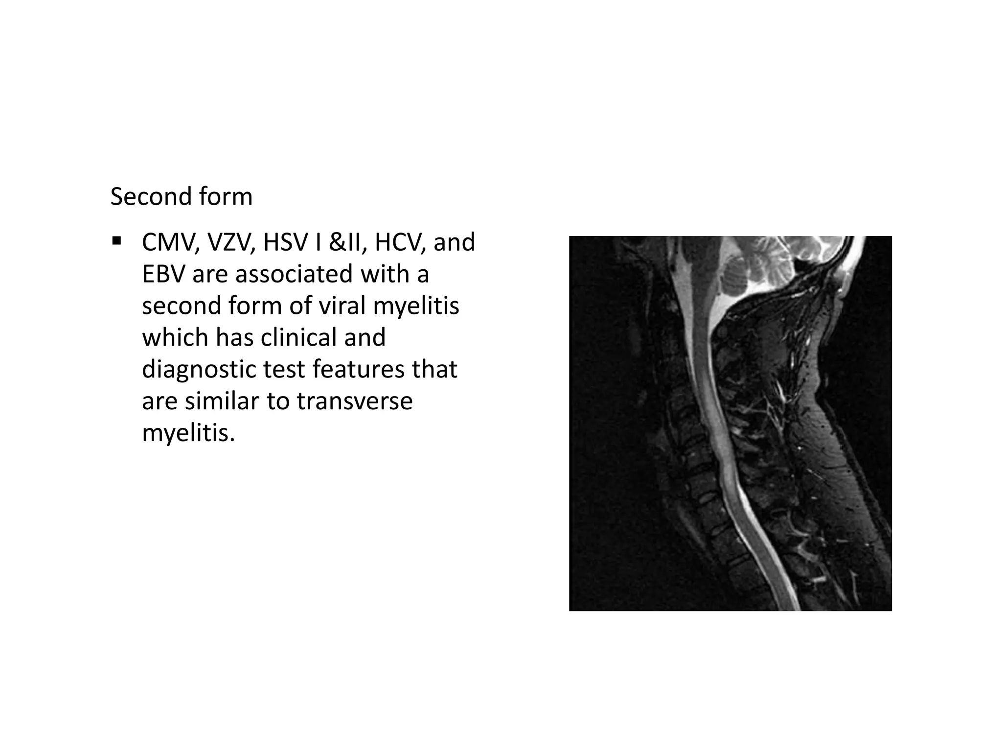 Second form
 CMV, VZV, HSV I &II, HCV, and
EBV are associated with a
second form of viral myelitis
which has clinical and
diagnostic test features that
are similar to transverse
myelitis.
 