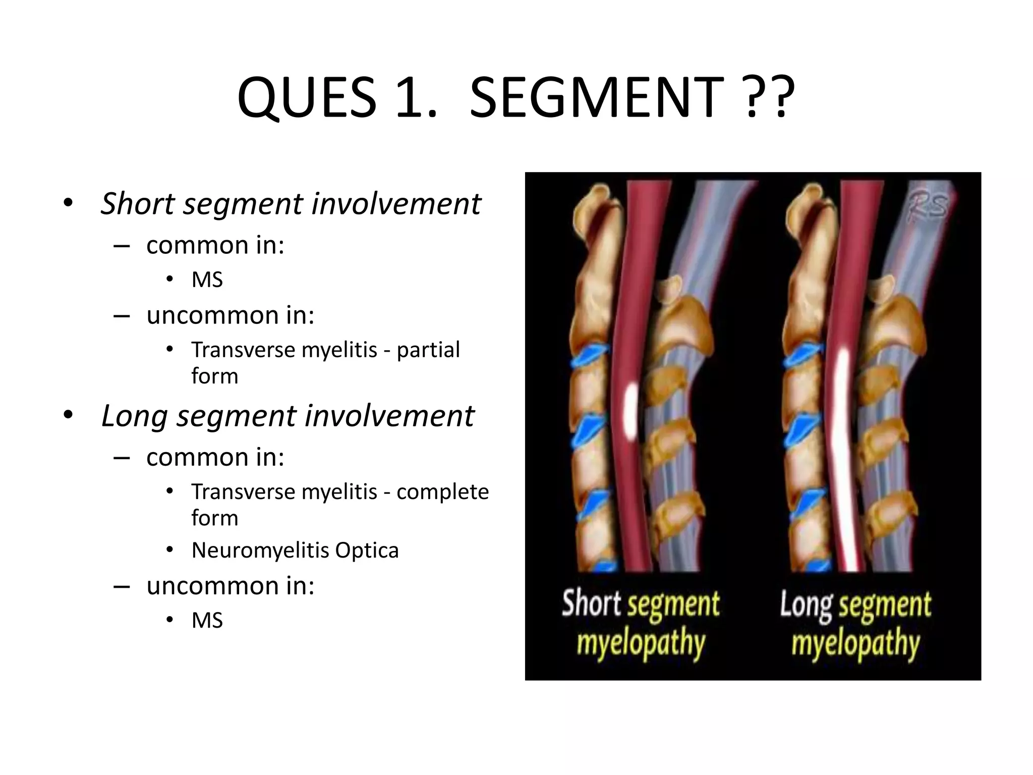 QUES 1. SEGMENT ??
• Short segment involvement
– common in:
• MS
– uncommon in:
• Transverse myelitis - partial
form
• Long segment involvement
– common in:
• Transverse myelitis - complete
form
• Neuromyelitis Optica
– uncommon in:
• MS
 