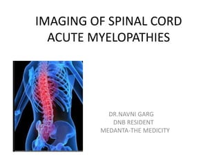 IMAGING OF SPINAL CORD
ACUTE MYELOPATHIES
DR.NAVNI GARG
DNB RESIDENT
MEDANTA-THE MEDICITY
 