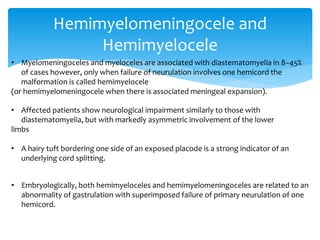 Hemimyelomeningocele and
Hemimyelocele
• Myelomeningoceles and myeloceles are associated with diastematomyelia in 8–45%
of cases however, only when failure of neurulation involves one hemicord the
malformation is called hemimyelocele
(or hemimyelomeningocele when there is associated meningeal expansion).
• Affected patients show neurological impairment similarly to those with
diastematomyelia, but with markedly asymmetric involvement of the lower
limbs
• A hairy tuft bordering one side of an exposed placode is a strong indicator of an
underlying cord splitting.
• Embryologically, both hemimyeloceles and hemimyelomeningoceles are related to an
abnormality of gastrulation with superimposed failure of primary neurulation of one
hemicord.
 