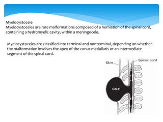Myelocystocele
Myelocystoceles are rare malformations composed of a herniation of the spinal cord,
containing a hydromyelic cavity, within a meningocele.
Myelocystoceles are classified into terminal and nonterminal, depending on whether
the malformation involves the apex of the conus medullaris or an intermediate
segment of the spinal cord.
 