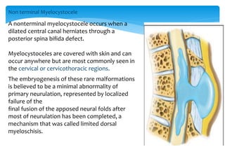 Non terminal Myelocystocele
A nonterminal myelocystocele occurs when a
dilated central canal herniates through a
posterior spina bifida defect.
Myelocystoceles are covered with skin and can
occur anywhere but are most commonly seen in
the cervical or cervicothoracic regions.
The embryogenesis of these rare malformations
is believed to be a minimal abnormality of
primary neurulation, represented by localized
failure of the
final fusion of the apposed neural folds after
most of neurulation has been completed, a
mechanism that was called limited dorsal
myeloschisis.
 