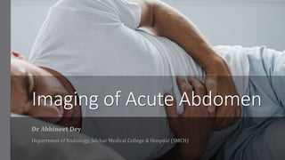 Imaging of Acute Abdomen
Dr Abhineet Dey
Department of Radiology, Silchar Medical College & Hospital (SMCH)
 