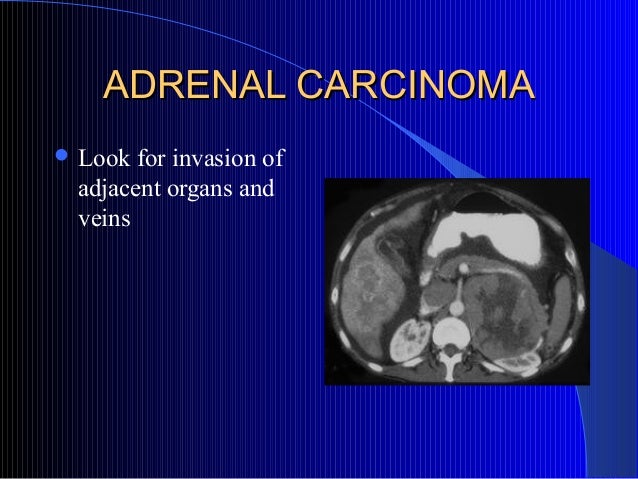 extra adrenal effect of the adrenal cortex extra adrenal effect of the adrenal cortex