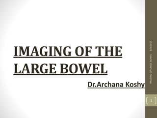 IMAGING OF THE
LARGE BOWEL
Dr.Archana Koshy
6/8/2017IMAGINGOFLARGEBOWEL
1
 