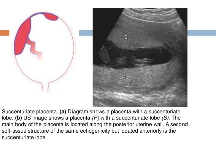 Imaging of the placenta