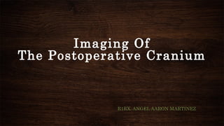Imaging Of
The Postoperative Cranium
R1RX. ANGEL AARON MARTINEZ
 