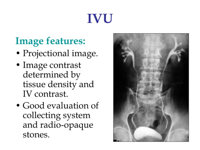 Imaging of the Renal System..........ppt | Medical Tests | Medical Health