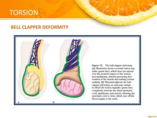 Imaging of the scrotum | PPTX