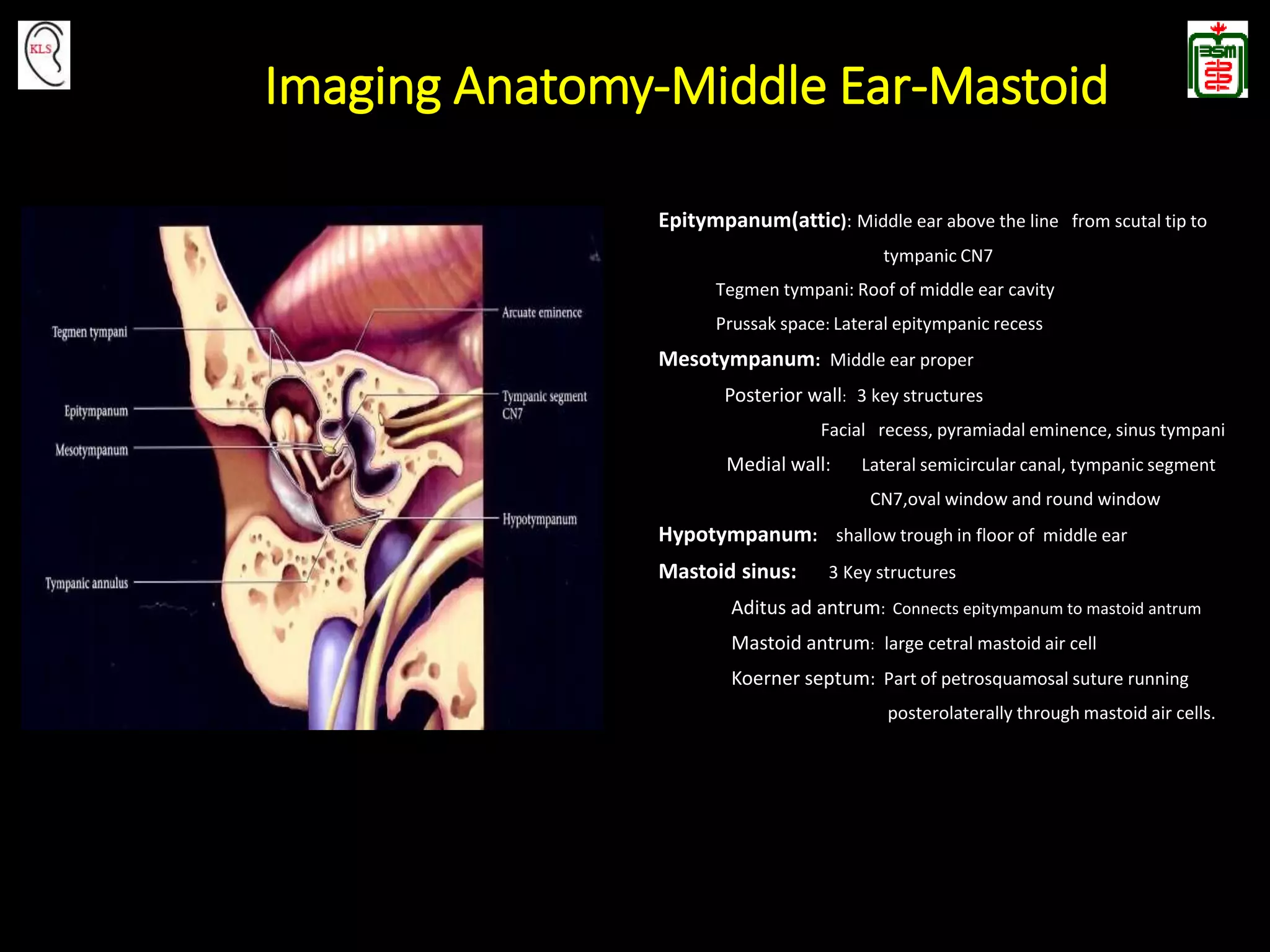 Imaging Of The Temporal Bone PPTX Imaging Of The Temporal Bone PPTX