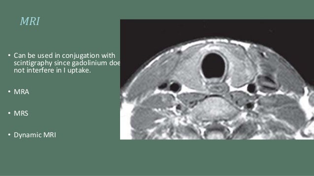 Thyroid lesions detected by mri
