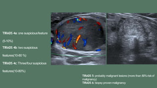 TIRADS 4a: one suspiciousfeature
(5-10%)
TIRADS 4b: two suspicious
features(10-80 %)
TIRADS 4c:Three/foursuspicious
features(10-80%)
TIRADS 5: probably malignant lesions (more than 80%riskof
malignancy)
TIRADS 6: biopsy proven malignancy
 