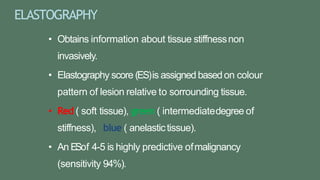 ELASTOGRAPHY
• Obtains information about tissue stiffnessnon
invasively.
• Elastography score (ES)is assigned basedon colour
pattern of lesion relative to sorrounding tissue.
• Red ( soft tissue), green ( intermediatedegree of
stiffness), blue ( anelastictissue).
• An ESof 4-5 is highly predictive ofmalignancy
(sensitivity 94%).
 