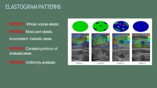 ELASTOGRAMPATTERNS
• P
A
T
T
E
R
N1: Whole nodule elastic
• P
A
T
T
E
R
N2: Most part elastic,
inconsistent inelastic areas
• P
A
T
T
E
R
N3: Constantportions of
anelasticareas
• P
A
T
T
E
R
N4: Uniformlyanelastic
 