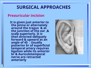 Preauricular Incision Steps Comprehensive Surgical Anatomy and Imaging of the Temporomandibular ...