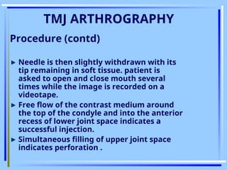 Comprehensive Surgical Anatomy and Imaging of the Temporomandibular ...