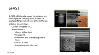 E Fast View IMAGING OF TRAUMATIC ABDOMINAL INJURY.pptx