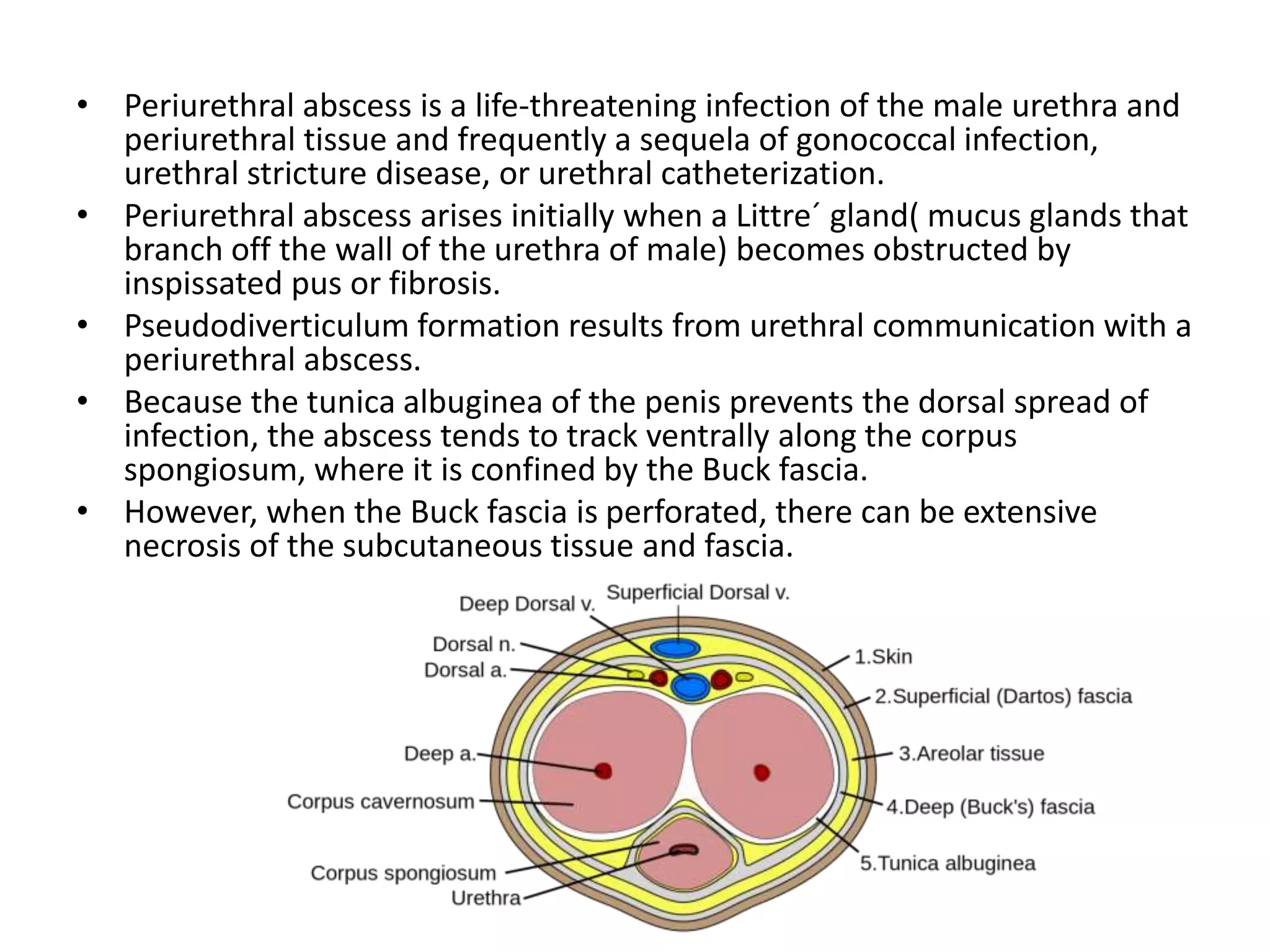 • Periurethral abscess is a life-threatening infection of the male urethra and
periurethral tissue and frequently a sequela of gonococcal infection,
urethral stricture disease, or urethral catheterization.
• Periurethral abscess arises initially when a Littre´ gland( mucus glands that
branch off the wall of the urethra of male) becomes obstructed by
inspissated pus or fibrosis.
• Pseudodiverticulum formation results from urethral communication with a
periurethral abscess.
• Because the tunica albuginea of the penis prevents the dorsal spread of
infection, the abscess tends to track ventrally along the corpus
spongiosum, where it is confined by the Buck fascia.
• However, when the Buck fascia is perforated, there can be extensive
necrosis of the subcutaneous tissue and fascia.
 