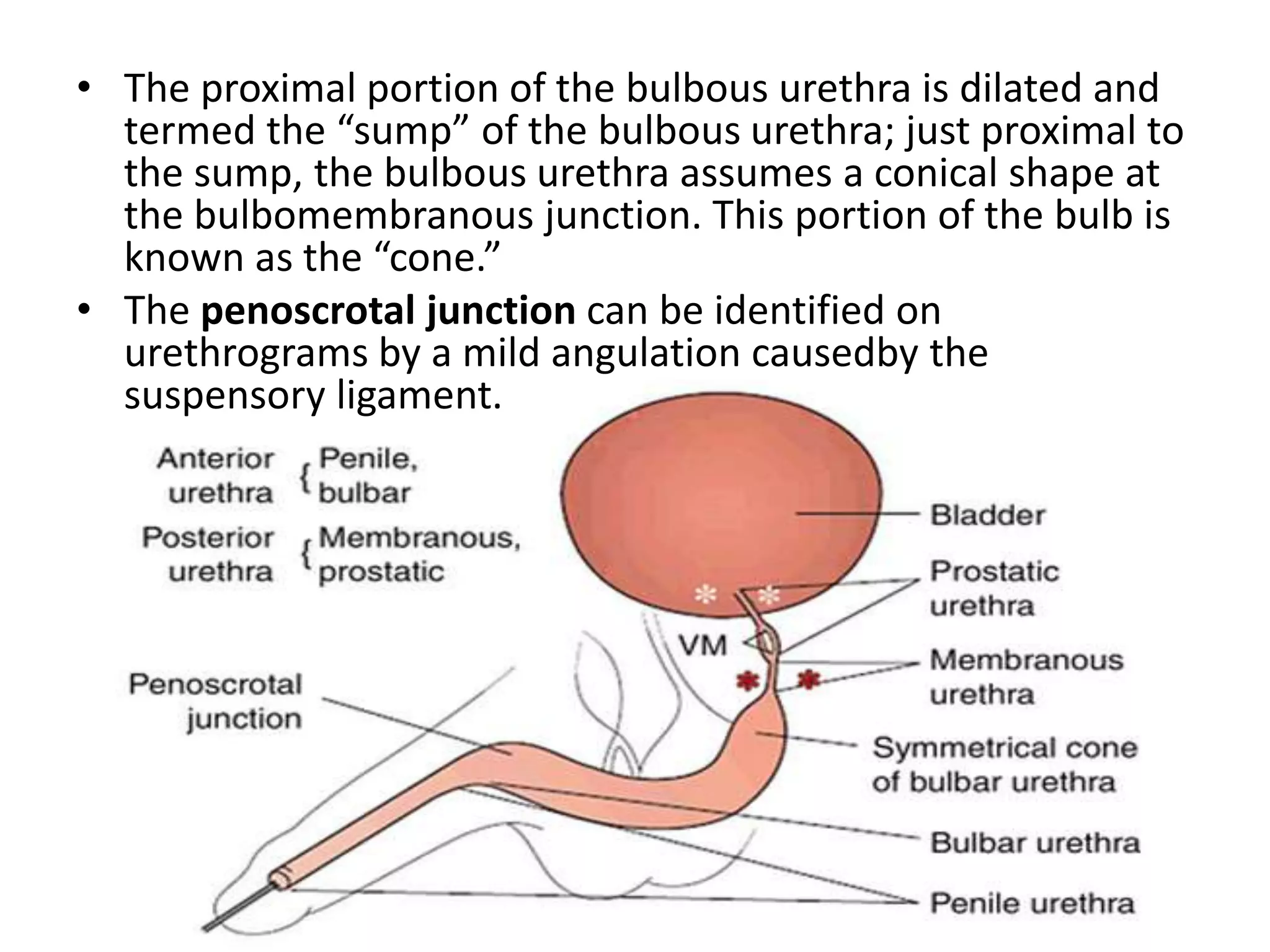 • The proximal portion of the bulbous urethra is dilated and
termed the “sump” of the bulbous urethra; just proximal to
the sump, the bulbous urethra assumes a conical shape at
the bulbomembranous junction. This portion of the bulb is
known as the “cone.”
• The penoscrotal junction can be identified on
urethrograms by a mild angulation causedby the
suspensory ligament.
 