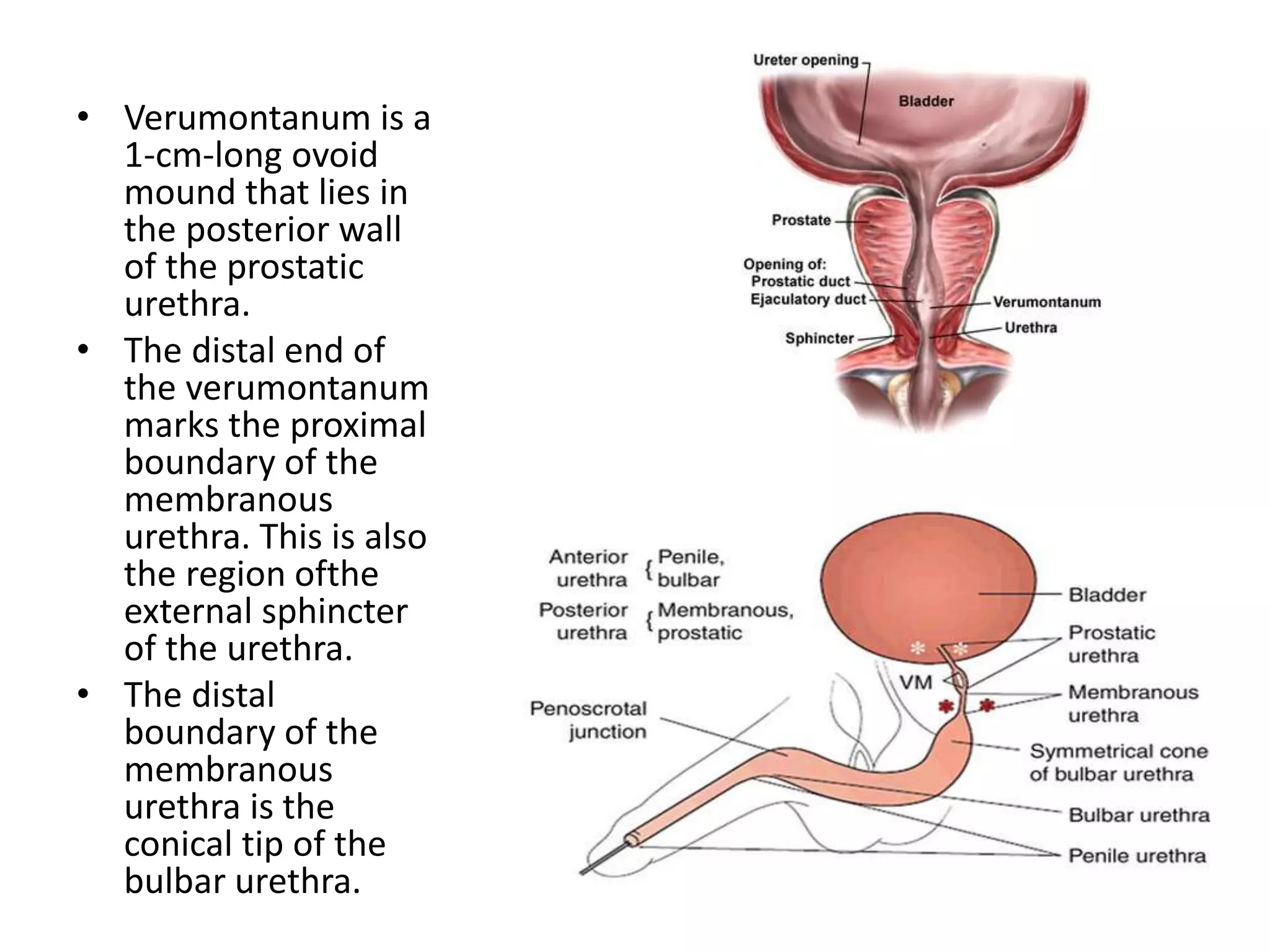 • Verumontanum is a
1-cm-long ovoid
mound that lies in
the posterior wall
of the prostatic
urethra.
• The distal end of
the verumontanum
marks the proximal
boundary of the
membranous
urethra. This is also
the region ofthe
external sphincter
of the urethra.
• The distal
boundary of the
membranous
urethra is the
conical tip of the
bulbar urethra.
 