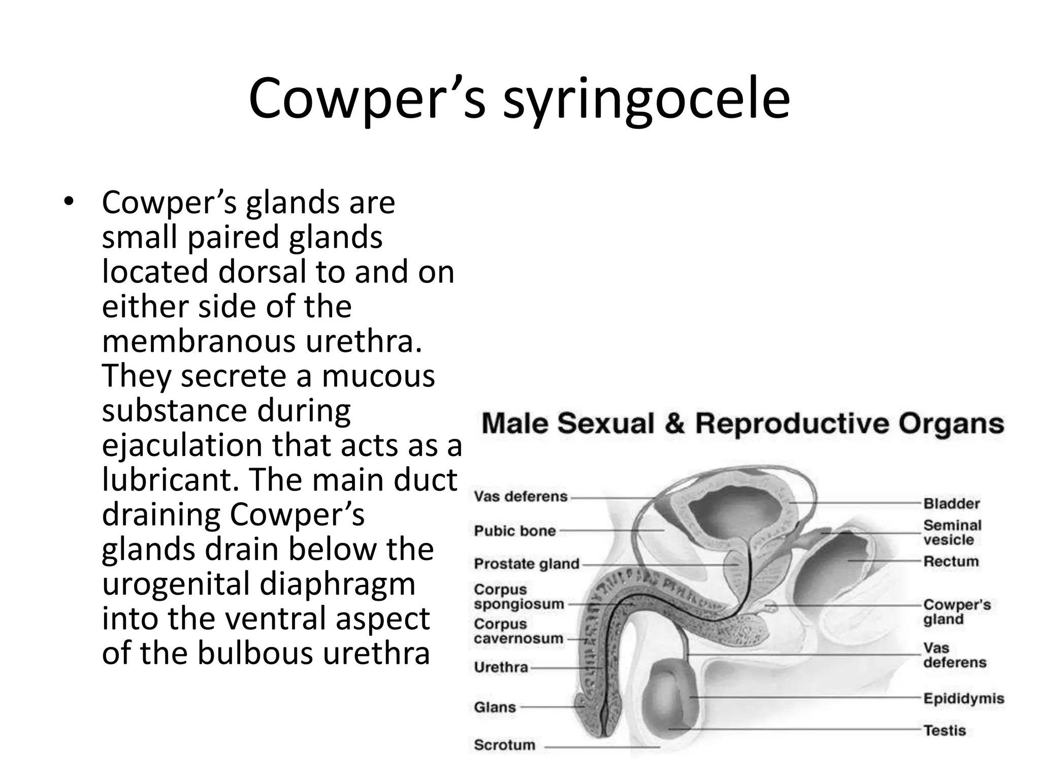 Cowper’s syringocele
• Cowper’s glands are
small paired glands
located dorsal to and on
either side of the
membranous urethra.
They secrete a mucous
substance during
ejaculation that acts as a
lubricant. The main duct
draining Cowper’s
glands drain below the
urogenital diaphragm
into the ventral aspect
of the bulbous urethra
 