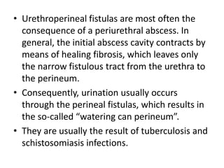 • Urethroperineal fistulas are most often the
consequence of a periurethral abscess. In
general, the initial abscess cavity contracts by
means of healing fibrosis, which leaves only
the narrow fistulous tract from the urethra to
the perineum.
• Consequently, urination usually occurs
through the perineal fistulas, which results in
the so-called “watering can perineum”.
• They are usually the result of tuberculosis and
schistosomiasis infections.
 