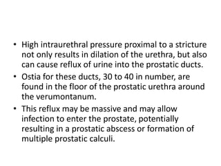 • High intraurethral pressure proximal to a stricture
not only results in dilation of the urethra, but also
can cause reflux of urine into the prostatic ducts.
• Ostia for these ducts, 30 to 40 in number, are
found in the floor of the prostatic urethra around
the verumontanum.
• This reflux may be massive and may allow
infection to enter the prostate, potentially
resulting in a prostatic abscess or formation of
multiple prostatic calculi.
 