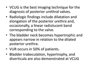 • VCUG is the best imaging technique for the
diagnosis of posterior urethral valves.
• Radiologic findings include dilatation and
elongation of the posterior urethra and,
occasionally, a linear radiolucent band
corresponding to the valve.
• The bladder neck becomes hypertrophic and
appears narrow in relation to the dilated
posterior urethra.
• VUR occurs in 50% of patients.
• Bladder trabeculation, hypertrophy, and
diverticula are also demonstrated at VCUG
 