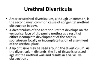 Urethral Diverticula
• Anterior urethral diverticulum, although uncommon, is
the second most common cause of congenital urethral
obstruction in boys.
• A diverticulum of the anterior urethra develops on the
ventral surface of the penile urethra as a result of
either incomplete development of the corpus
spongiosum focally or incomplete fusion of a segment
of the urethral plate.
• A lip of tissue may be seen around the diverticulum. As
the diverticulum distends, the lip of tissue is pressed
against the urethral wall and results in a valve like
obstruction .
 