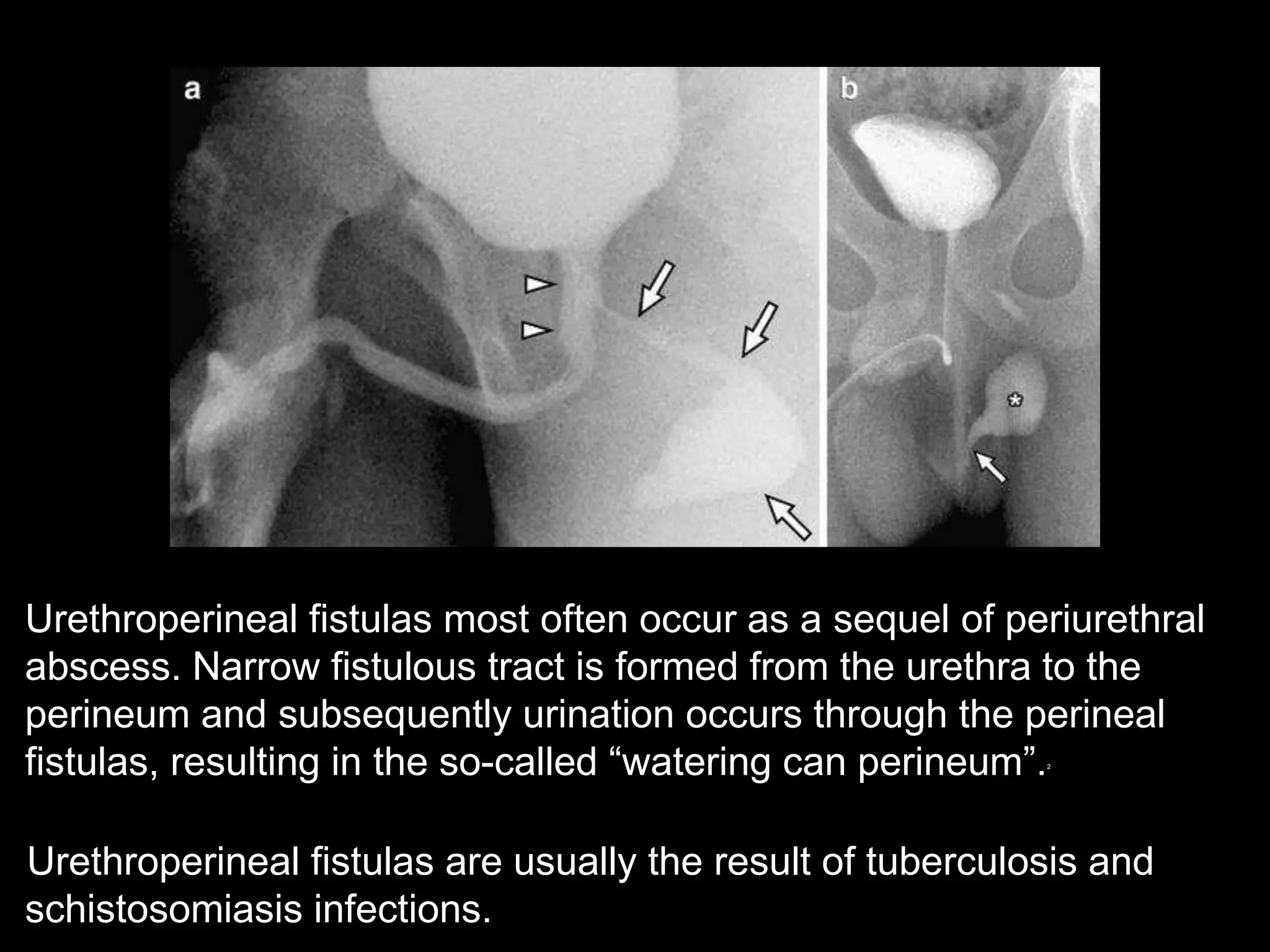 Imaging of urinary bladder and urethra | PPTX