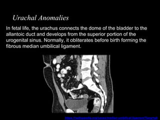 Imaging of urinary bladder and urethra | PPTX