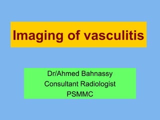 Imaging of vasculitis 
Dr/Ahmed Bahnassy 
Consultant Radiologist 
PSMMC 
 