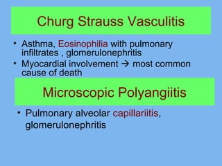 Churg Strauss Vasculitis 
• Asthma, Eosinophilia with pulmonary 
infiltrates , glomerulonephritis 
• Myocardial involvement  most common 
cause of death 
Microscopic Polyangiitis 
• Pulmonary alveolar capillariitis, 
glomerulonephritis 
 