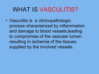 WHAT IS VASCULITIS? 
• Vasculitis is a clinicopathologic 
process characterized by inflammation 
and damage to blood vessels,leading 
to compromise of the vascular lumen 
resulting in ischemia of the tissues 
supplied by the involved vessels. 
 