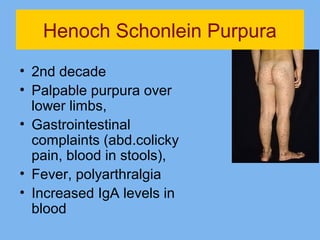Henoch Schonlein Purpura 
• 2nd decade 
• Palpable purpura over 
lower limbs, 
• Gastrointestinal 
complaints (abd.colicky 
pain, blood in stools), 
• Fever, polyarthralgia 
• Increased IgA levels in 
blood 
 