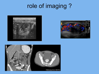 role of imaging ? 
 