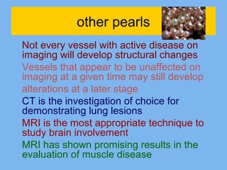 other pearls 
Not every vessel with active disease on 
imaging will develop structural changes 
Vessels that appear to be unaffected on 
imaging at a given time may still develop 
alterations at a later stage 
CT is the investigation of choice for 
demonstrating lung lesions 
MRI is the most appropriate technique to 
study brain involvement 
MRI has shown promising results in the 
evaluation of muscle disease 
 