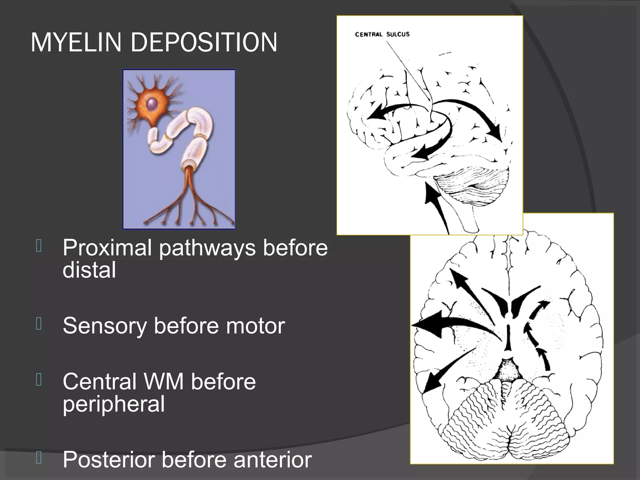 Imaging of white matter diseases | PPT