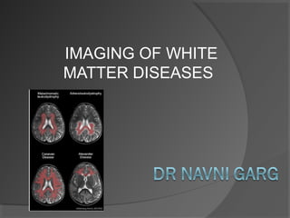 IMAGING OF WHITE
MATTER DISEASES
 