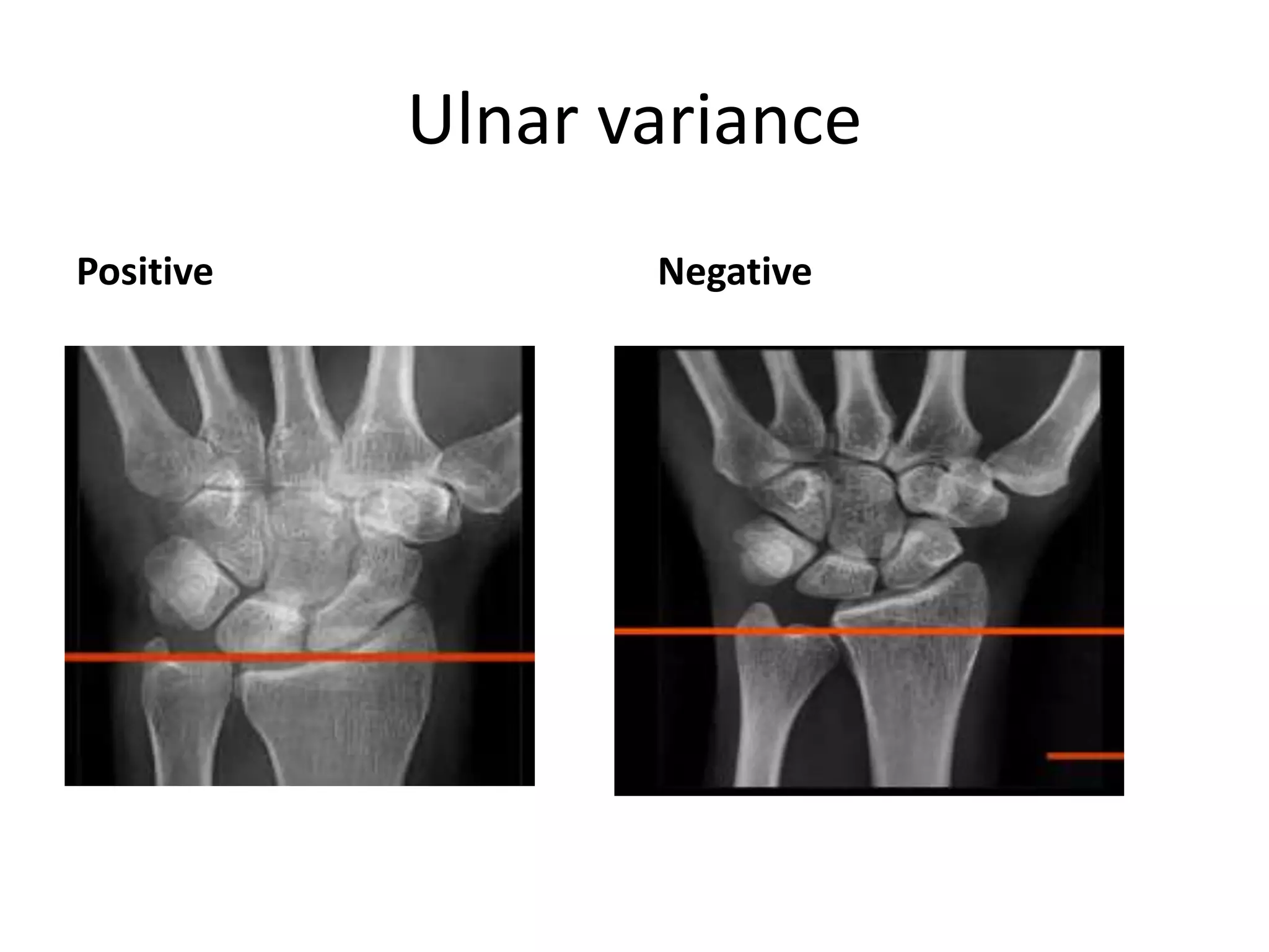 Imaging Of Wrist Joint PPTX