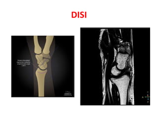 Imaging of wrist joint | PPTX