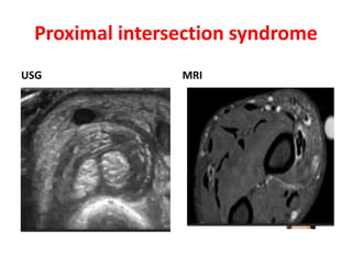 Mri Scanner Intersection Imaging of wrist joint | PPTX