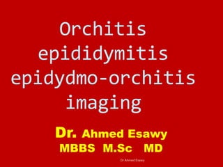 Orchitis
epididymitis
epidydmo-orchitis
imaging
Dr. Ahmed Esawy
MBBS M.Sc MD
Dr Ahmed Esawy
 