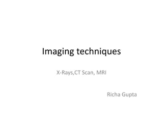 Imaging techniques
X-Rays,CT Scan, MRI
Richa Gupta
 