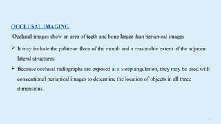 2 7
OCCLUSAL IMAGING
Occlusal images show an area of teeth and bone larger than periapical images
 It may include the palate or floor of the mouth and a reasonable extent of the adjacent
lateral structures.
 Because occlusal radiographs are exposed at a steep angulation, they may be used with
conventional periapical images to determine the location of objects in all three
dimensions.
 